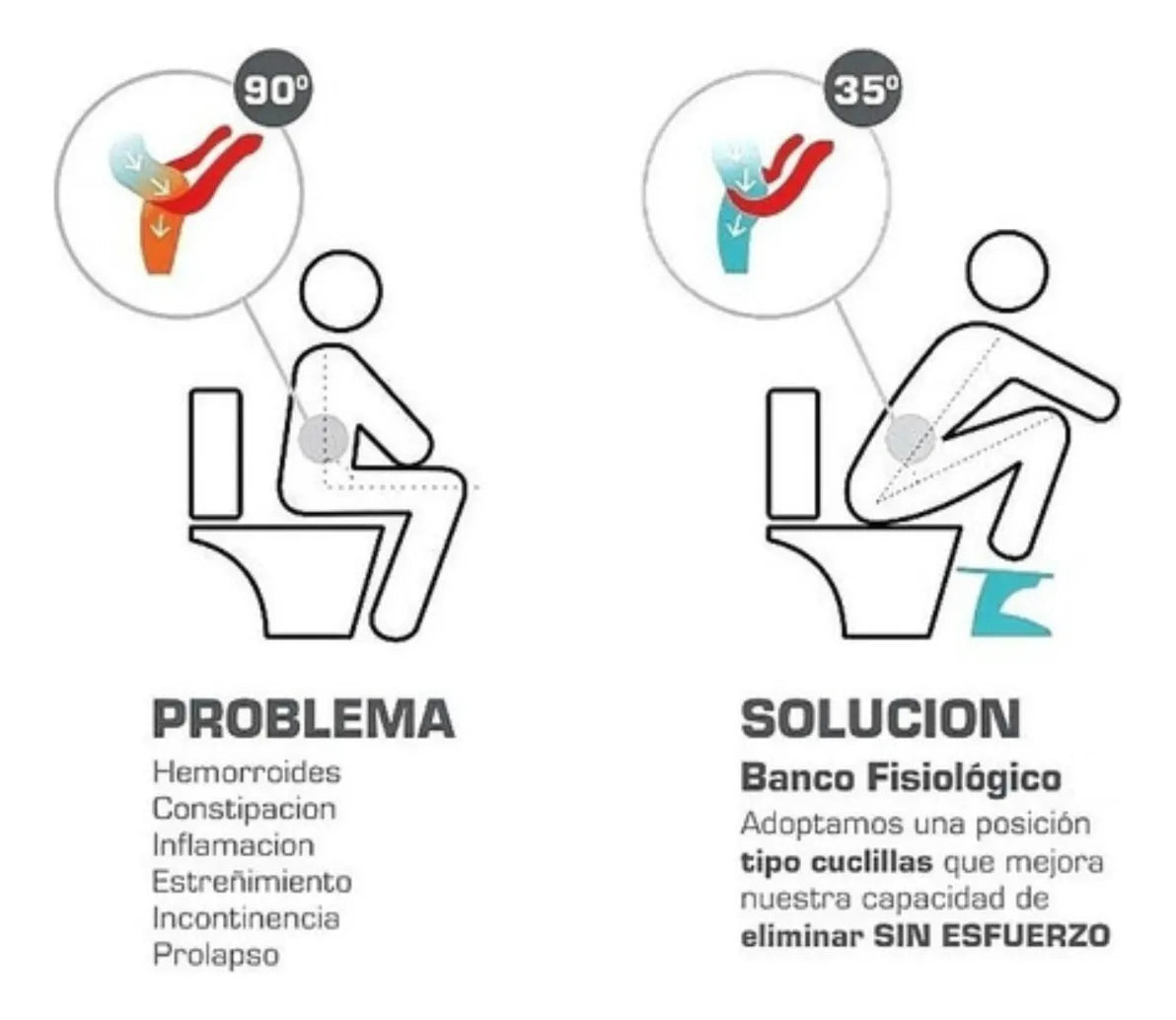 Banquito Sanitario Fisiológico para Inodoro